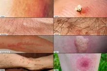 Nos prestations sur le secteur de à Carcassonne (11)